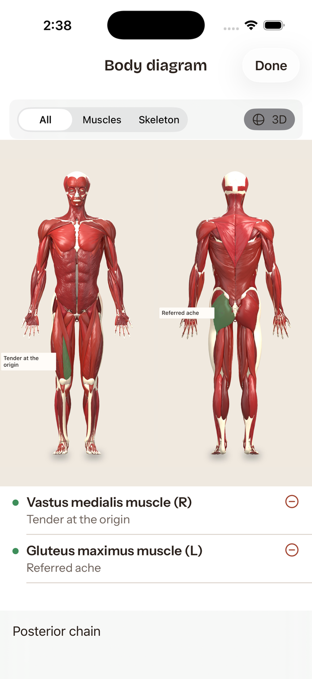 A body diagram with two muscles marked and notes attached to them